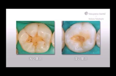 Tokuyama-Asteria-Shades-and-Layering-Part-2-of-4